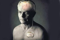 【健康解碼】起搏器真的能治好帕金森病嗎？